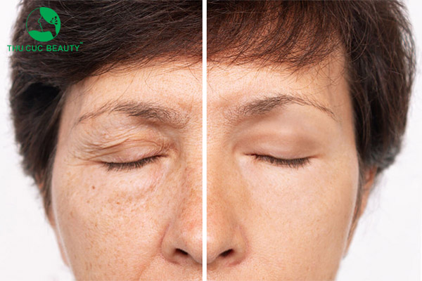 Nâng cung chân mày được bao lâu? Lưu ý để dáng mày bền lâu