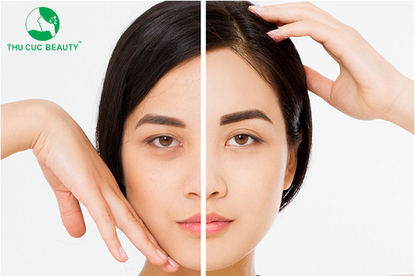 Nâng cung mày có nguy hiểm không? Lưu ý để hạn chế rủi ro