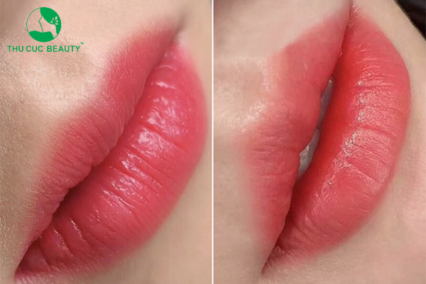 Phun môi pha lê và phun môi collagen có gì khác biệt?