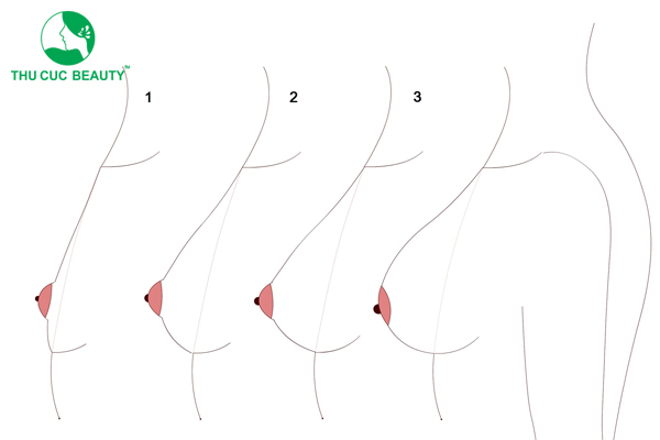 Sự phát triển của bầu ngực