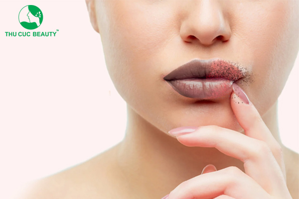 Bật mí 15 cách trị môi thâm tại nhà hiệu quả, nhanh chóng
