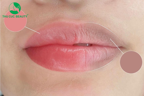 Bác sĩ tư vấn: Khử thâm môi ăn gì cho lên màu đẹp?