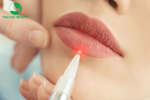 Khử thâm môi giá bao nhiêu? Bảng giá chi tiết dịch vụ
