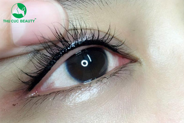 Mắt 1 mí có nên phun mí mở tròng?