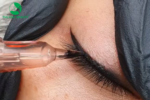 Cách phân biệt phun mí mở tròng và phun mí thường