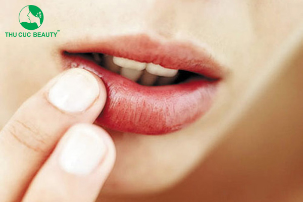 Phun môi nhiều lần có sao không? 6 tác hại cần biết