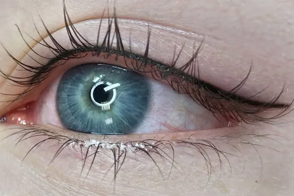 Xăm mí mắt có hại không? Những lưu ý cần biết khi thực hiện