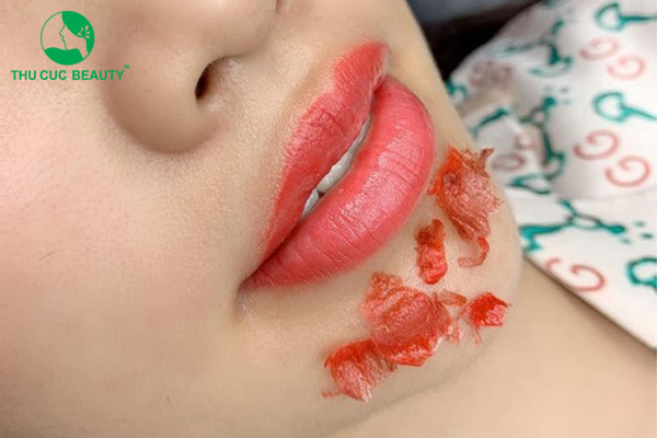 4 nguyên nhân xăm môi mãi không lành