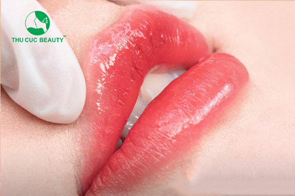 Điểm danh 7 tác hại của phun môi collagen phải biết