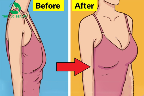 Điểm danh 11+ bài tập cho ngực chảy xệ