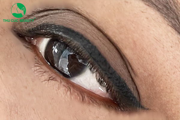 Dấu hiệu cho thấy phun mí hỏng và cách khắc phục