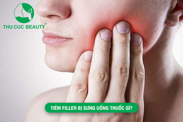 Tiêm filler bị sưng uống thuốc gì?