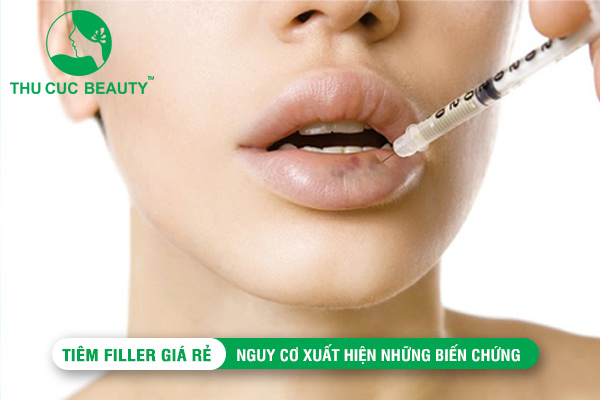 Tiêm filler giá rẻ: Nguy cơ xuất hiện những biến chứng