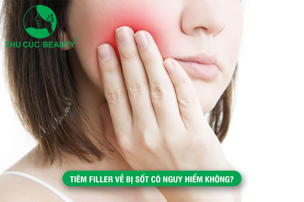 Tiêm filler về bị sốt