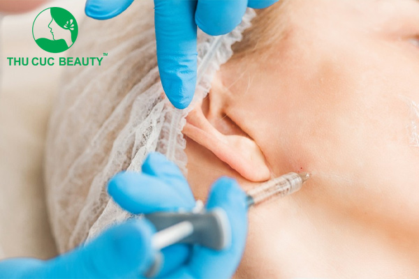 Cảnh báo tiêm botox gọn hàm giá rẻ