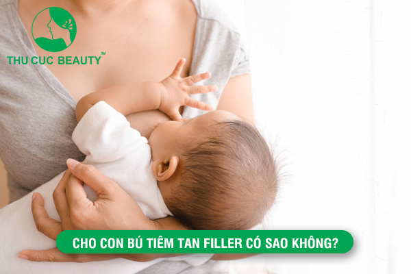 Đang cho con bú tiêm tan filler có sao không?