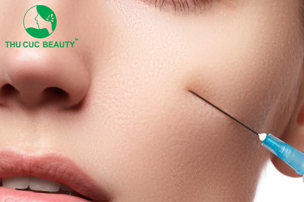 đối tượng chỉ định tiêm filler má