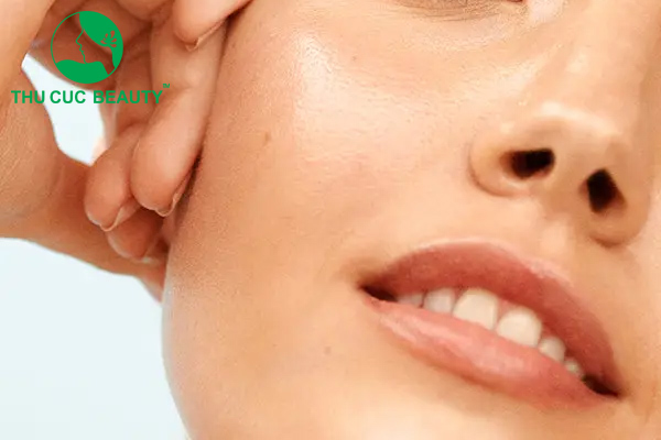 khắc phục biến chứng tiêm filler má