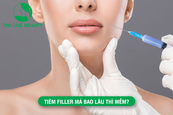 Tiêm filler má bao lâu thì mềm?