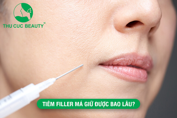 Tiêm filler má giữ được bao lâu