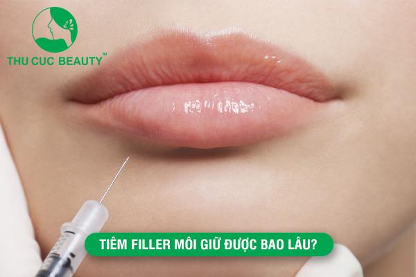 Tiêm filler môi giữ được bao lâu?