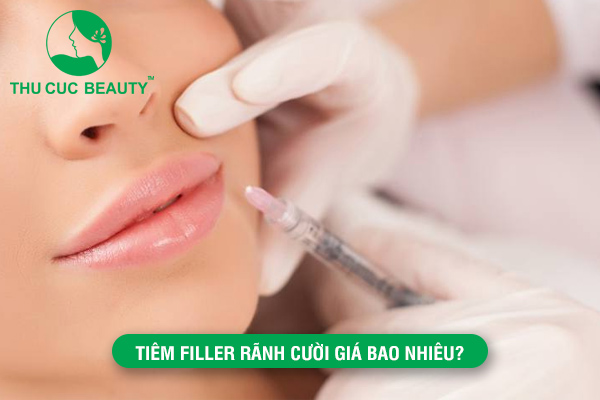 Tiêm filler rãnh cười giá bao nhiêu?