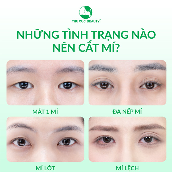 Tình trạng mắt ảnh hưởng đến chi phí cắt mí