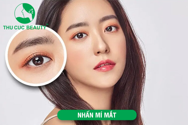 Nhấn mí mắt là gì?