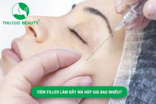 Tiêm filler làm đầy má hóp giá bao nhiêu? Có nên tiêm làm đầy má hóp không?