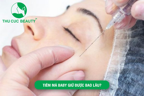 Tiêm má baby giữ được bao lâu?