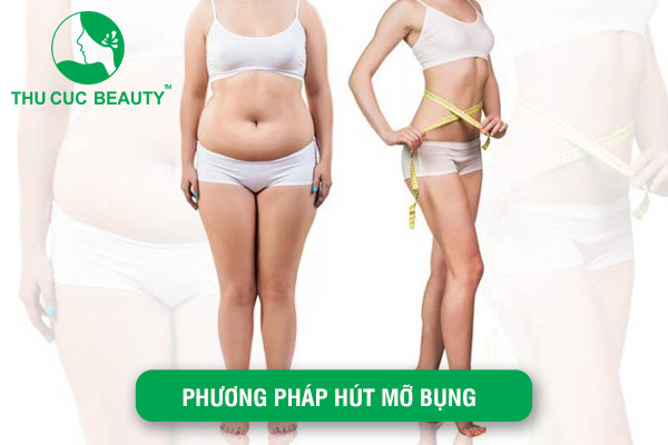 Phương pháp hút mỡ bụng