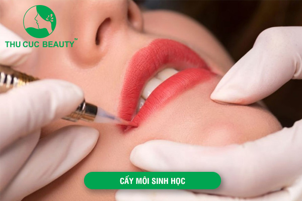 Cấy môi sinh học là gì?