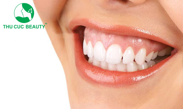 Điều trị cười hở lợi: Các phương pháp thực hiện hiệu quả, an toàn