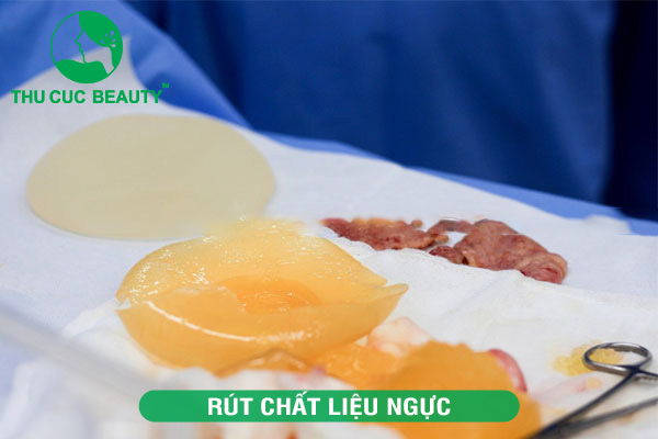Rút chất liệu ngực: Phẫu thuật tháo túi ngực an toàn
