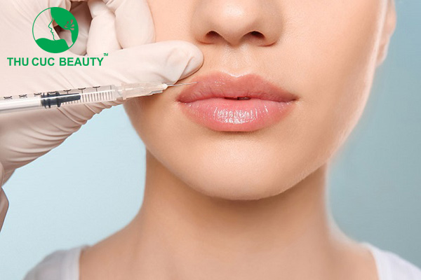 Điều trị cười hở lợi bằng botox