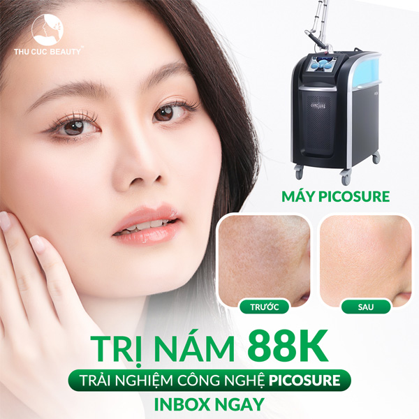 Trị nám TC - Trẻ hóa da với công nghệ Picosure