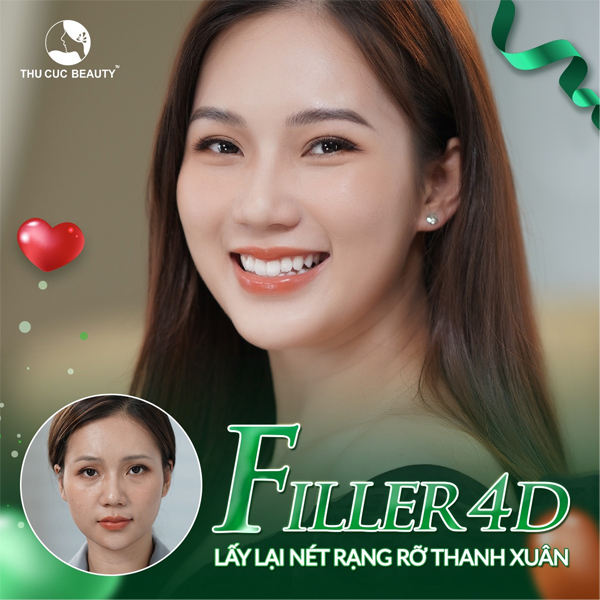 Tiêm filler: Bí quyết trẻ hóa làn da không phẫu thuật