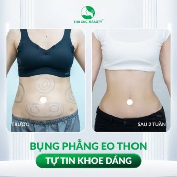 Thu gọn bụng – Giải pháp cho vòng 2 thon gọn