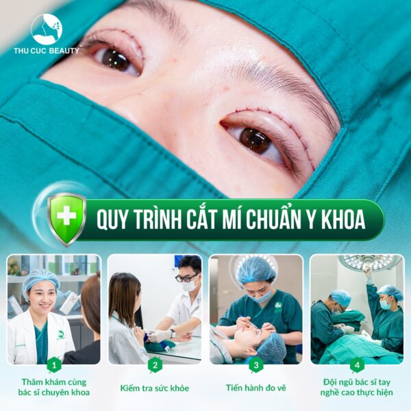 Quy trình tạo hình sụp mí bẩm sinh