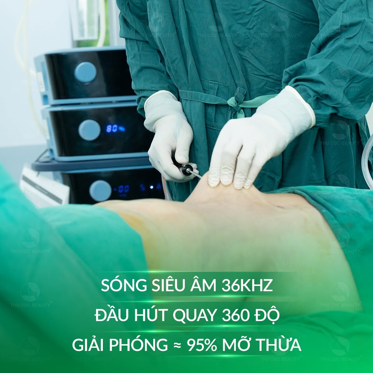 Hút mỡ nọng cằm bằng công nghệ Vaser Lipo cho hiệu quả cao, an toàn.