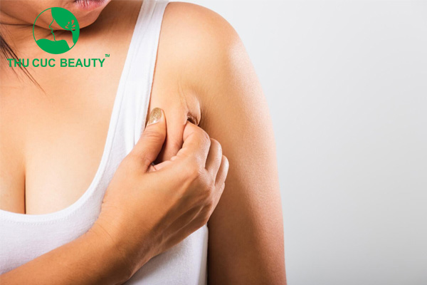Đối tượng phù hợp để định hình vùng nách