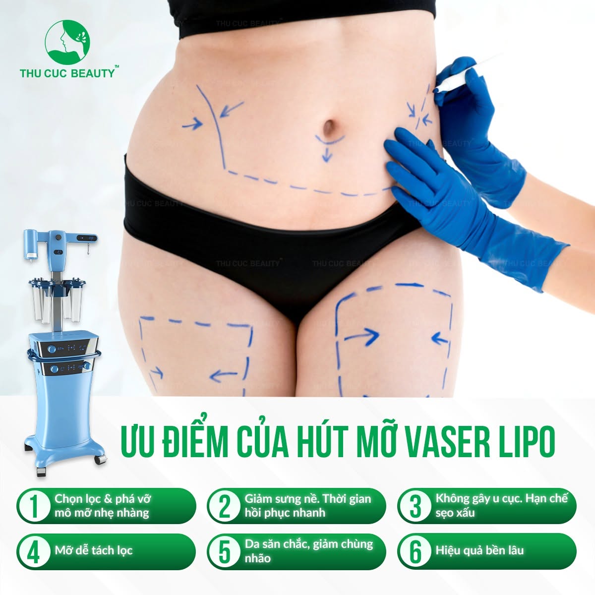 Thiết kế đùi thon là phương pháp loại bỏ mỡ thừa ở đùi hiệu quả một cách tinh tế, mang lại vẻ đẹp ưng ý.