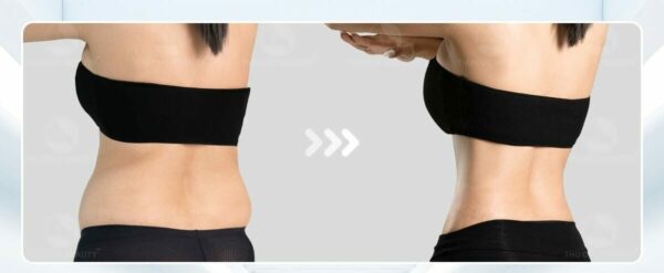 Định hình vùng lưng giúp lấy lại vóc dáng thanh mảnh, nữ tính.