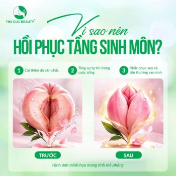Thẩm mỹ tầng sinh môn sau sinh