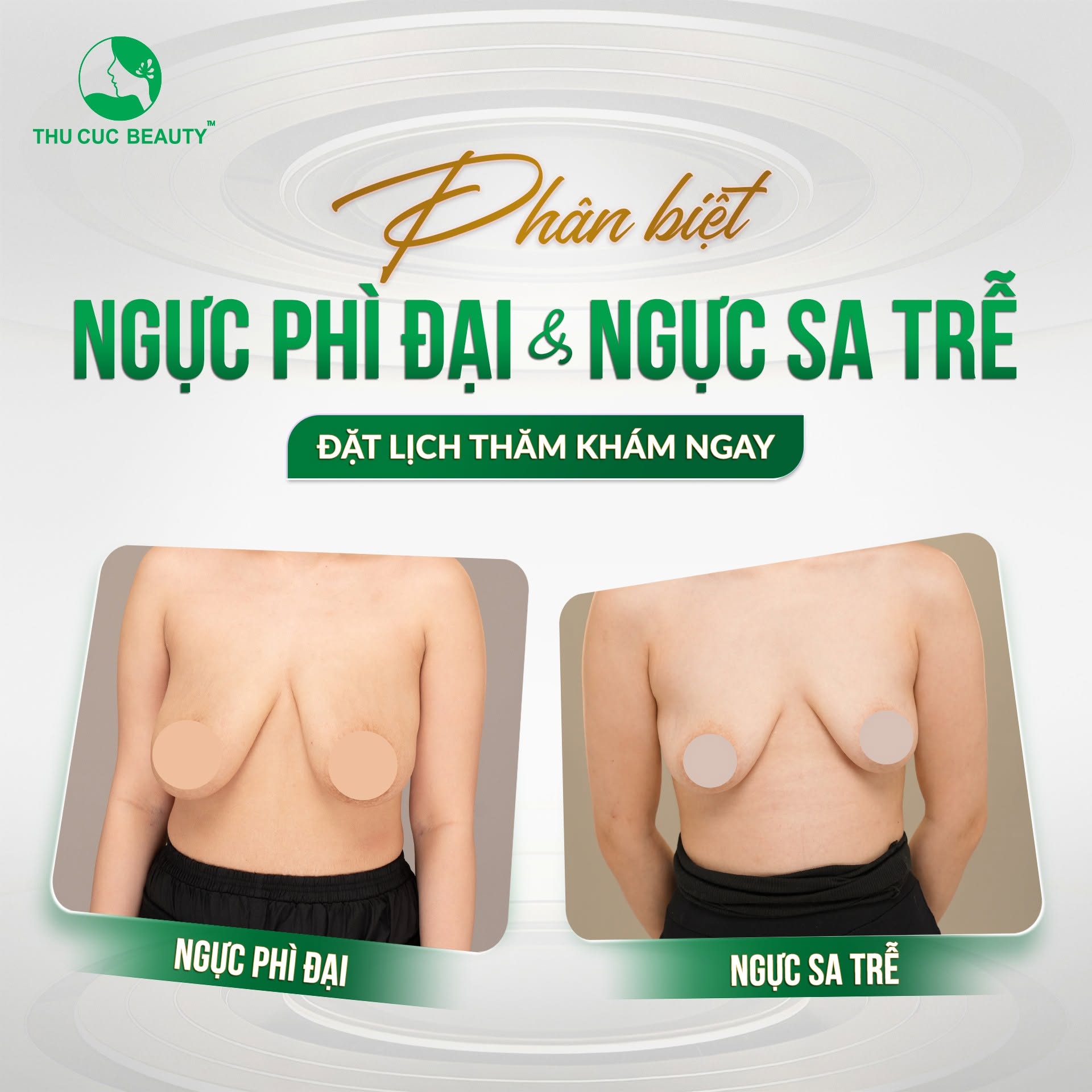 Thu nhỏ ngực phì đại