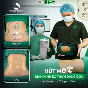 Hút mỡ có để lại sẹo không? Những lưu ý phòng tránh sẹo
