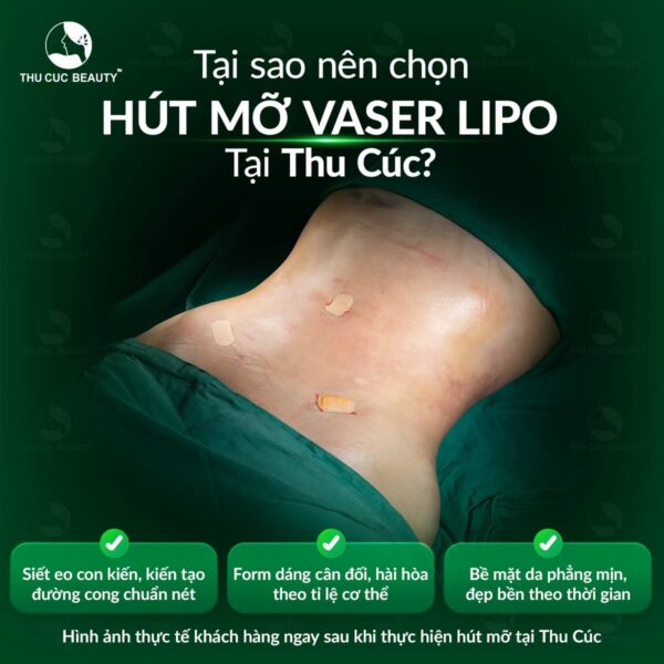 Hút mỡ có để lại sẹo không?
