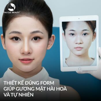 Nâng mũi bao lâu thì vào “form”? Làm thế nào để nhanh vào “form”?