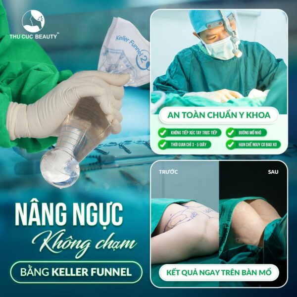 Nâng ngực không chạm