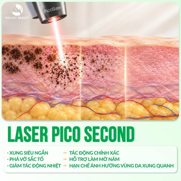 Trị nám bằng công nghệ laser mang đến kết quả tối ưu